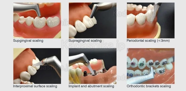 VolDent AirJet 1 歯面清掃器 エアフローデバイス (歯肉縁上ハンドピースのみ）